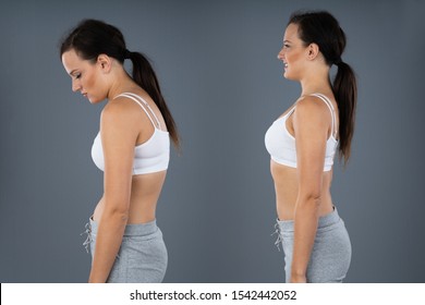 Woman With Lordosis And Normal Curvature Against Gray Background