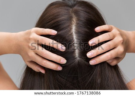 A woman is massaging her scalp.