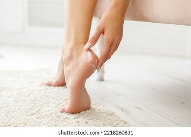 woman moisturizes dry skin on heels with cream. skin care