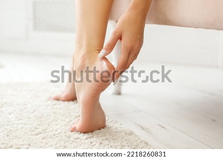woman moisturizes dry skin on heels with cream. skin care