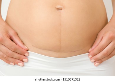 Woman Giving Birth Nude - Naked Birth Images, Stock Photos & Vectors | Shutterstock