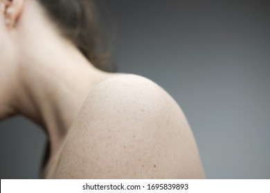 Woman With No Face Exposing Her Right Shoulder And Neck With Pale Skin And Freckles