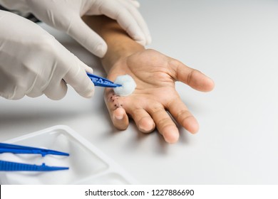 Woman Nurse With Gloves Using Cotton Wool Moistened With Alcohol Cleaning The Wound On The Hand Of The Young Man.