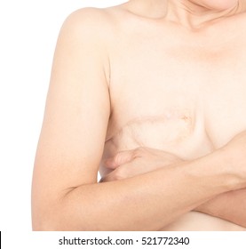 Woman  One Breast Cancer Awareness Ribbon And Scar From Surgery