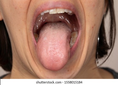Woman with open mouth showing tongue