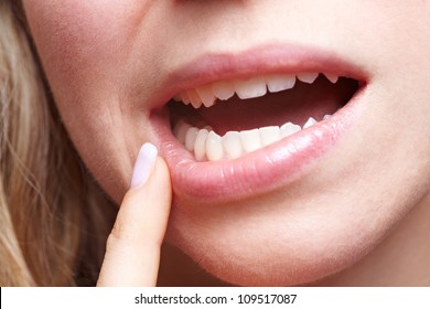 Woman With Pain In Her Gums Holding Finger To Mouth