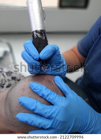 woman performing capillary micropigmentation on man