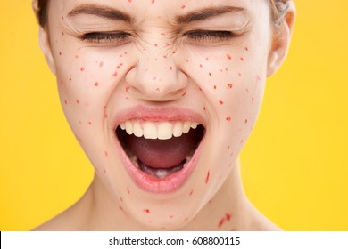 Download Pimples Face Mask Images Stock Photos Vectors Shutterstock PSD Mockup Templates