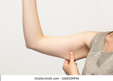 Woman pinching the flabby muscle and unwanted excess skin under her arm