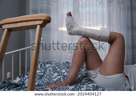 Woman in a plaster cast lies on the bed at home, crutches lie nearby. High quality photo