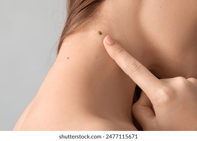 Woman pointing at mole on her neck against grey background, closeup