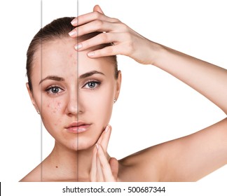 Woman with problem skin