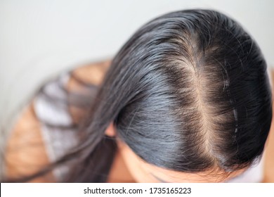 Woman with problem thin hair.