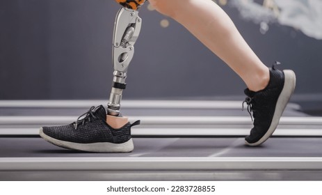 Woman with prosthetic leg using walking on treadmill while working out in gym. - Powered by Shutterstock