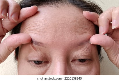 A Woman Pulling Her Fingers On The Skin Of Her Forehead.