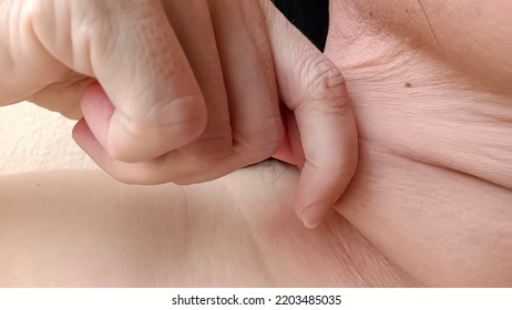 A Woman Pulls Her Fingers Through The Wrinkled Skin On Her Neck.