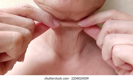 A Woman Pulls Her Fingers Through The Wrinkled Skin On Her Neck.