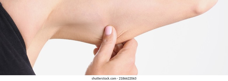 A Woman Pulls The Skin On Her Arm, Close-up. Loose Skin, Female Musculature, Workout At Home, Slimming