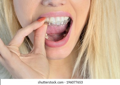 Woman Put Mouth Guard On Teeth