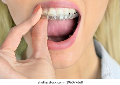 Woman Put Mouth Guard On Teeth
