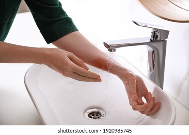 Woman putting burned hand under running cold water indoors, closeup - Powered by Shutterstock