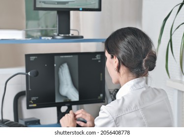 Woman Radiologist Looking At Monitor With An X-ray Image Of A Foot. Examining And Diagnostics Of A Trauma. Rear View Of Young Female X-ray Doctor