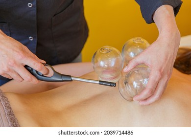 Woman receiving chinese medicine treatment with suction cups by a woman doctor. Multiple vacuum cup of medical cupping therapy on back.