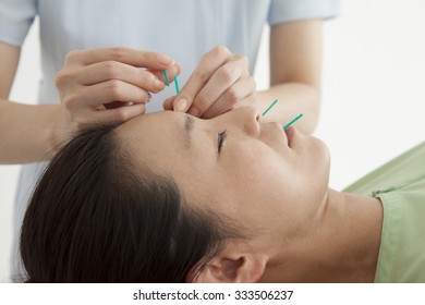 Woman To Relax Received Acupuncture In The Face