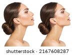 Woman Rhinoplasty. Women Nose Shape Before and After Plastic Surgery. Beauty Model Profile Side View over isolated White background