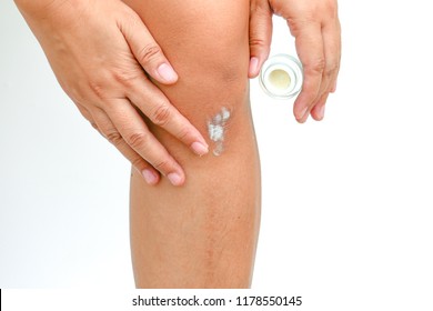 The Woman Rub The Medicine Cream On Her Knee, On The White Background. 