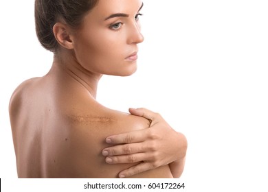 Женщина со шрамом на плече на белом фоне