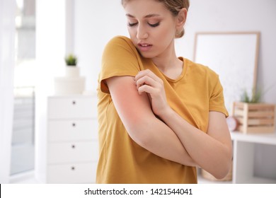 Woman scratching arm indoors, space for text. Allergy symptoms - Shutterstock ID 1421544041