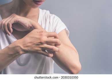 Woman scratching arm with itchy skin fungus, air allergy, chemical allergy.