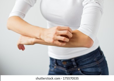 Woman Scratching Her Arm.