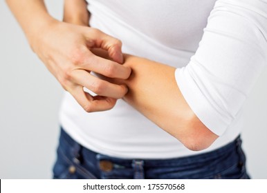 Woman Scratching Her Arm.