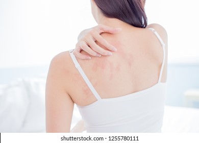woman scratching her shoulder and neck because of dry skin at home