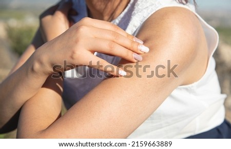Woman scratching her shoulder at the outdoor. Allergy
