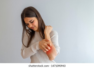 Woman Scratching An Itch On White Background . Sensitive Skin, Food Allergy Symptoms, Irritation. People Scratch The Itch With Hand, Arm, Itching, Concept With Healthcare And Medicine.