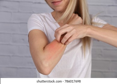 Frau Kratzend auf weißem Hintergrund . Empfindliche Haut, allergische Ernährungssymptome, Reizung