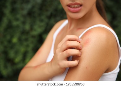 Woman scratching shoulder with insect bite outdoors, closeup