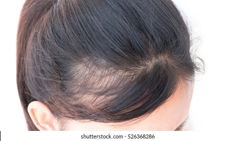 1000 Old Women Thin Hair Stock Images Photos Vectors