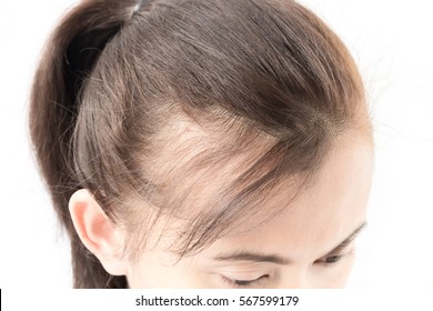 1000 Old Women Thin Hair Stock Images Photos Vectors