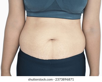 Woman show off the belly after birth have stretch marks on white background. Closeup photo, blurred. - Shutterstock ID 2373896871