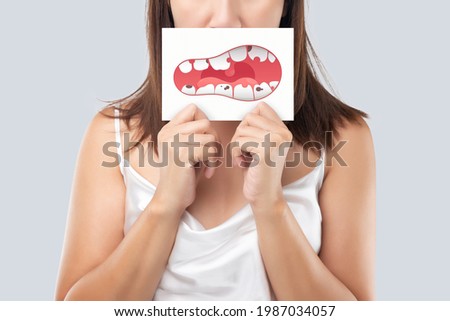 The woman show the picture of caries problems, Illustration health gums and teeth on a white paper. Decayed tooth.