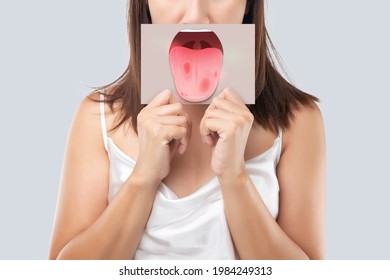 The woman show the picture of tongue problems, Illustration benign migratory glossitis on a brown paper, Behcet's Disease