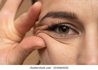 woman showing her eye wrinkles with her fingers on a white background. - Shutterstock ID 2154464103