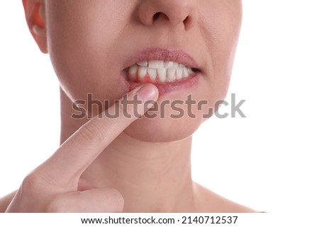 Woman showing inflamed gums on white background, closeup view