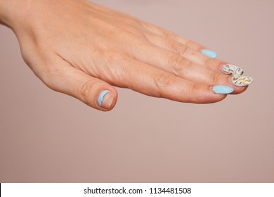 Woman Shows Broken Nail