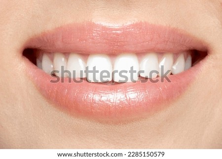Woman smile. Teeth whitening. Dental care