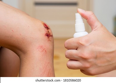 Woman Sprays An Antiseptic Agent On The Wound On The Childs Knee. Treatment The Wound. First Aid.